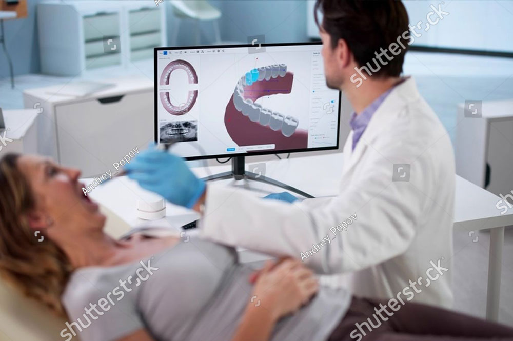 3D Guided Dental Implant
