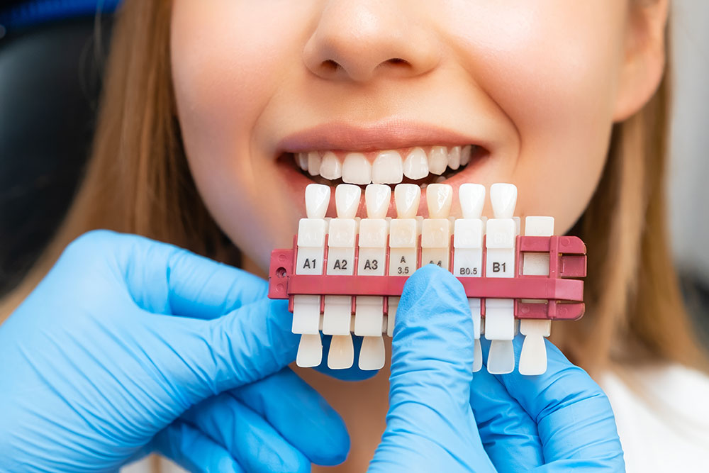 A dentist comparing a patient’s tooth colour with a set of dental implants