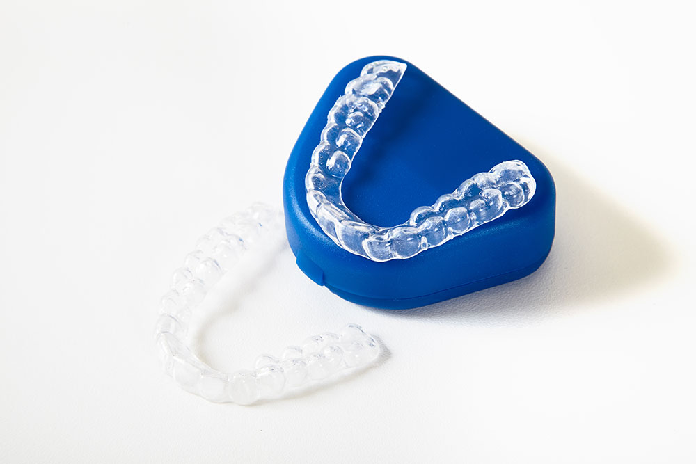 What Is Invisalign?