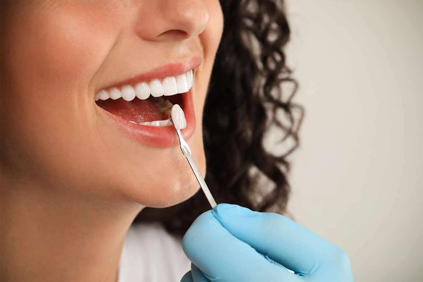 Dentist examining a young woman's teeth colour for dental veneer preparation
