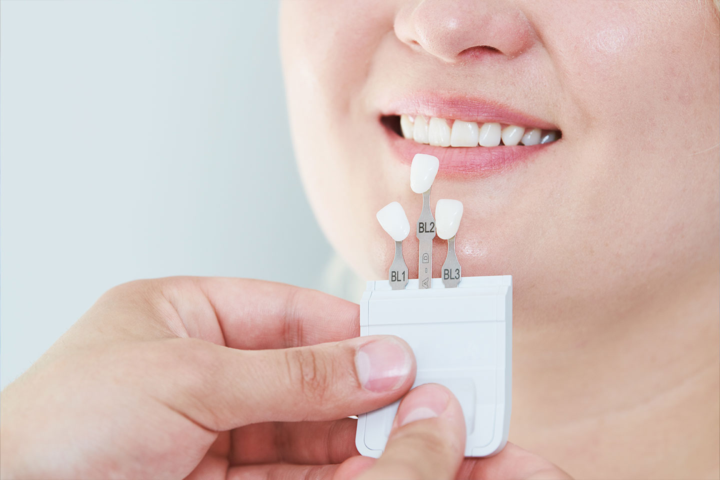 A dentist matches the colour of a dental veneer to the patient's natural teeth