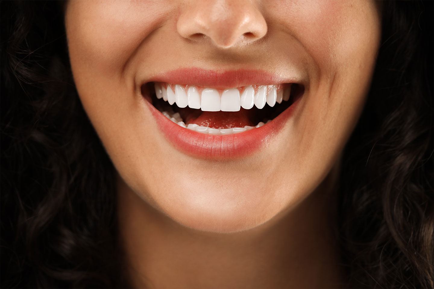 A close-up of a smiling woman with dental veneers