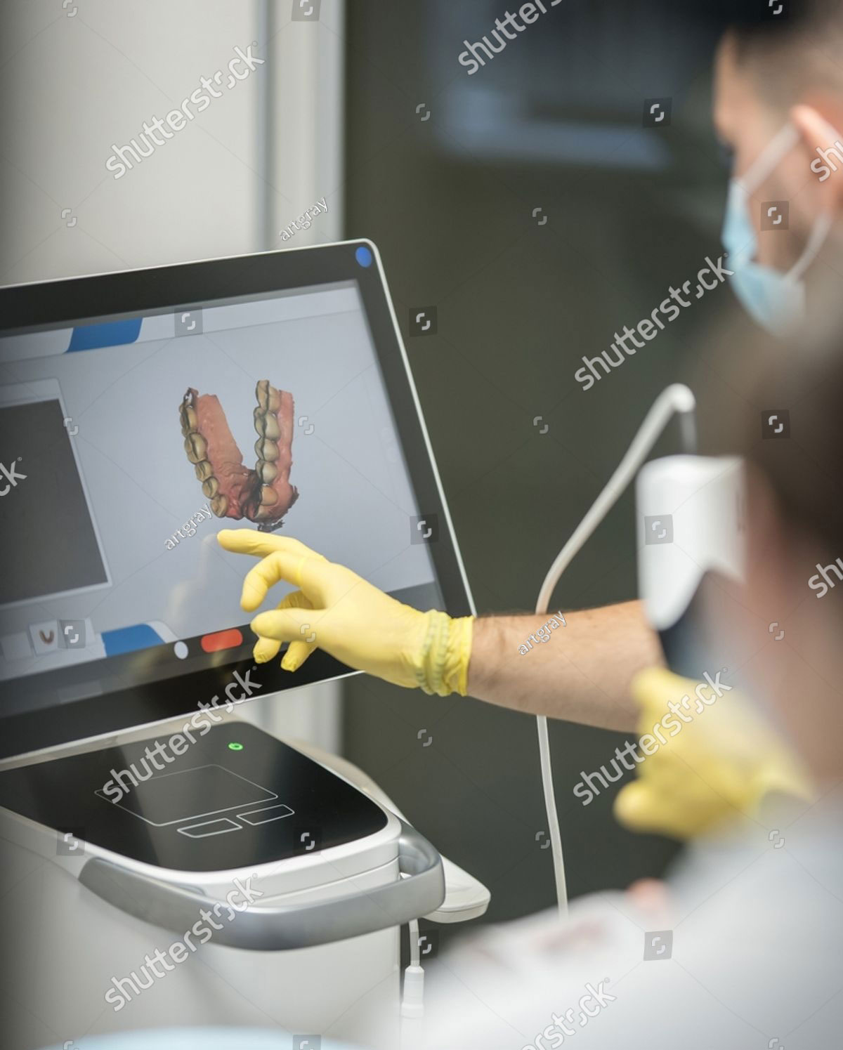 3D Guided Dental Implant