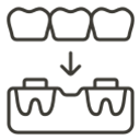 Dental Bridge
