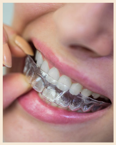 Main treatment - Invisalign